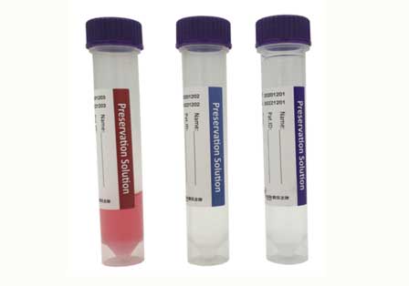 jenis-virus-specimen-medium-untuk-swab-test