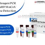 Review Reagen PCR STANDARD M nCoV Real-Time Detection
