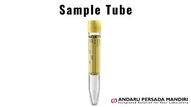 ilustrasi gambar sample tube urine