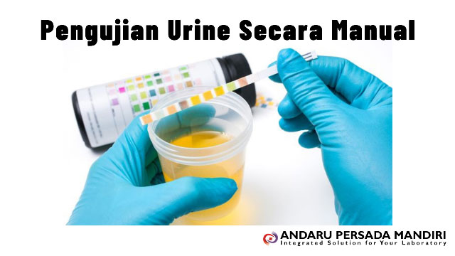 ilustrasi gambar Pengujian urine secara manual