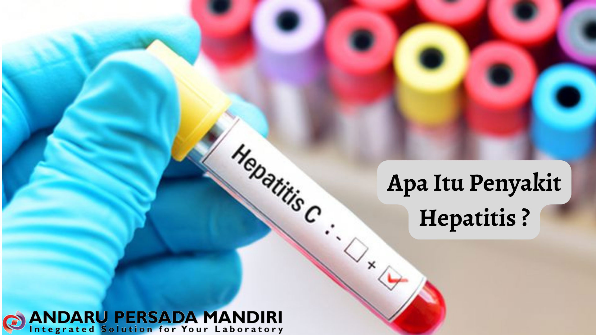 contoh gambar penyakit hepatitis