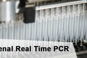 Real Time PCR – Mengenal Real Time PCR (RT-PCR, qPCR)