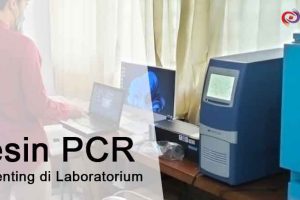 Mesin PCR adalah Alat Penting di Laboratorium: Informasi dan Harga Terbaru